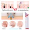 Ultimate 5-Level Electric Blackhead Remover – Powerful Pore Vacuum Acne & Facial Cleaner