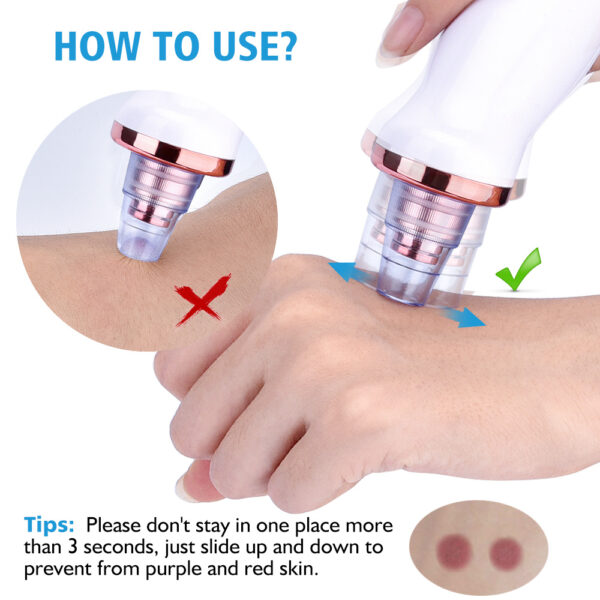 Ultimate 5-Level Electric Blackhead Remover – Powerful Pore Vacuum Acne & Facial Cleaner