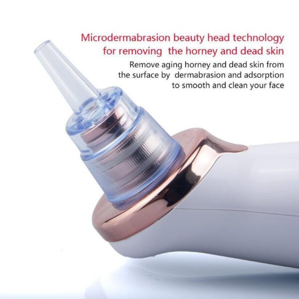 Ultimate 5-Level Electric Blackhead Remover – Powerful Pore Vacuum Acne & Facial Cleaner